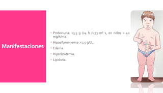 Manifestaciones
 Proteinuria: >3,5 g /24 h /1,73 m² s, en niños > 40
mg/h/m2.
 Hipoalbuminemia: <2,5 g/dL.
 Edema.
 Hiperlipidemia.
 Lipiduria.
 