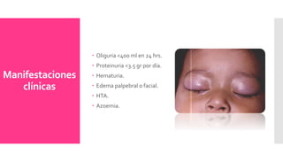 Manifestaciones
clínicas
 Oliguria <400 ml en 24 hrs.
 Proteinuria <3.5 gr por día.
 Hematuria.
 Edema palpebral o facial.
 HTA.
 Azoemia.
 