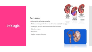 Etiología
Post-renal
 Obstrucción de las vías urinarias:
 Medicamentos que interfieren con el normal vaciado de la vejiga.
 Hipertrofia benigna de próstata o cáncer de próstata.
 Cálculos renales.
 Neoplasias.
 Catéter urinario obstruido.
 