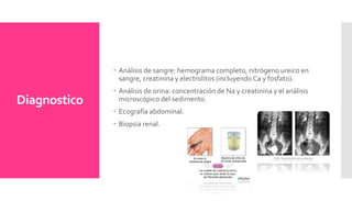 Diagnostico
 Análisis de sangre: hemograma completo, nitrógeno ureico en
sangre, creatinina y electrolitos (incluyendo Ca y fosfato).
 Análisis de orina: concentración de Na y creatinina y el análisis
microscópico del sedimento.
 Ecografía abdominal.
 Biopsia renal.
 