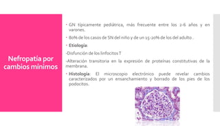 Nefropatía por
cambios mínimos
 GN típicamente pediátrica, más frecuente entre los 2-6 años y en
varones.
 80% de los casos de SN del niño y de un 15-20% de los del adulto .
 Etiología:
-Disfunción de los linfocitosT
-Alteración transitoria en la expresión de proteínas constitutivas de la
membrana.
 Histología: El microscopio electrónico puede revelar cambios
caracterizados por un ensanchamiento y borrado de los pies de los
podocitos.
 