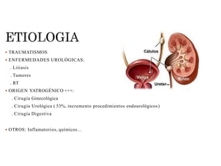  TRAUMATISMOS
 ENFERMEDADES UROLÓGICAS:
. Litiasis
. Tumores
. RT
 ORIGEN YATROGÉNICO +++:
. Cirugía Ginecológica
. Cirugía Urológica ( 53%, incremento procedimientos endourológicos)
. Cirugía Digestiva
 OTROS: Inflamatorios, químicos…
 