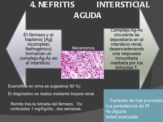 4. NEFRITIS  INTERSTICIAL AGUDA  Mecanismos Eosinófilos en orina es sugestiva( 80 %)  El diagnóstico se realiza mediante biopsia renal  Remite tras la retirada del fármaco.  Tto corticoides 1 mg/Kg/día , dos semanas. Factores de mal pronóstico: La persistencia de IR  la oliguria  edad avanzada  