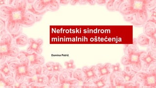 Domina Petrić
Nefrotski sindrom
minimalnih oštećenja
ALLPPT.com _ Free PowerPoint Templates, Diagrams and Charts
 