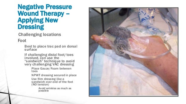 surgery negative pressure wound therapy surgery negative pressure wound therapy