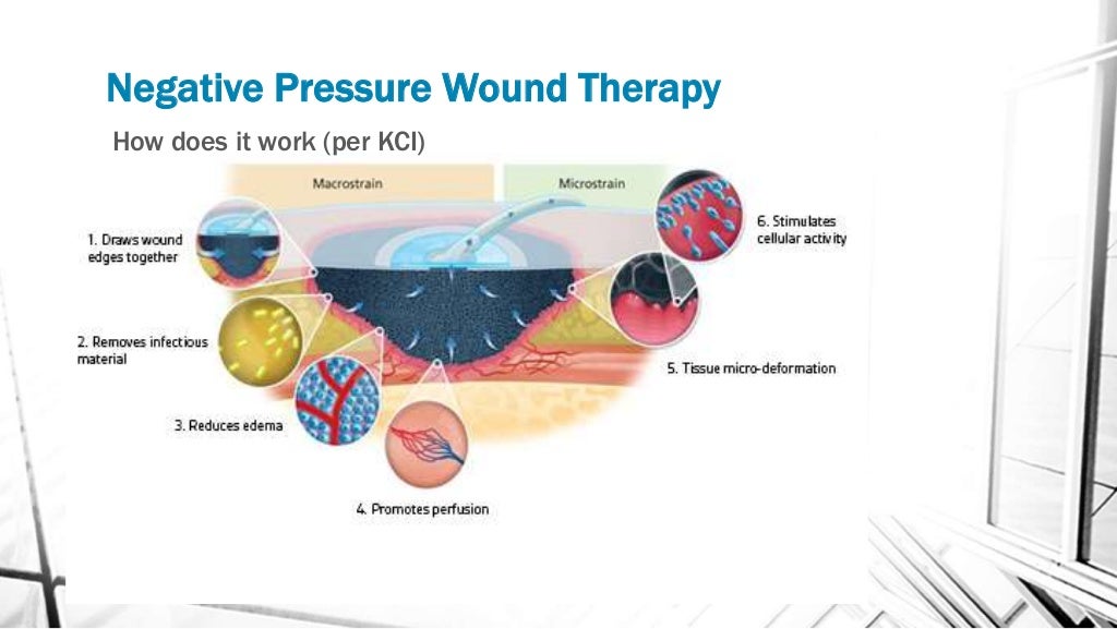 Negative pressure wound therapy