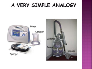 Pump
Canister
Sponge
Pump
Canister
Sponge
 