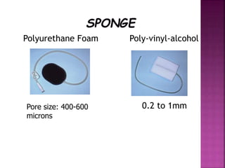 Polyurethane Foam Poly-vinyl-alcohol
0.2 to 1mmPore size: 400-600
microns
 