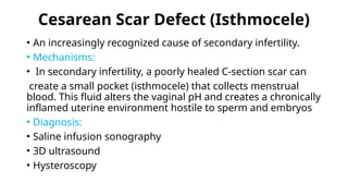 Cesarean Scar Defect (Isthmocele)
• An increasingly recognized cause of secondary infertility.
• Mechanisms:
• In secondary infertility, a poorly healed C-section scar can
create a small pocket (isthmocele) that collects menstrual
blood. This fluid alters the vaginal pH and creates a chronically
inflamed uterine environment hostile to sperm and embryos
• Diagnosis:
• Saline infusion sonography
• 3D ultrasound
• Hysteroscopy
 