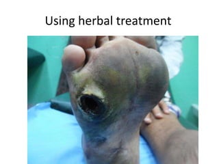 Using herbal treatment
 