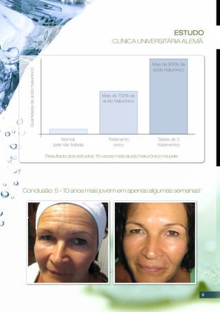 Conclusão: 5 - 10 anos mais jovem em apenas algumas semanas!
Quantidadedeácidohialurónico
Normal,
pele não tratada
Mais de 700% de
ácido hialurónico
Tratamento
único
Mais de 900% de
ácido hialurónico
Séries de 3
tratamentos
Resultado dos estudos: 10 vezes mais ácido hialurónico na pele
Estudo
Clínica universitária alemã.
6
 