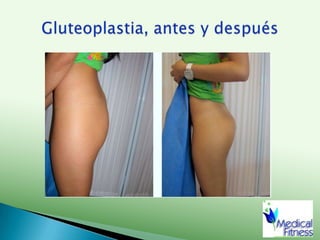 Rápida recuperación.