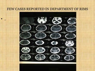 FEW CASES REPORTED IN DEPARTMENT OF RIMS
• . • .
 