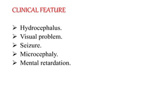 CLINICAL FEATURE
 Hydrocephalus.
 Visual problem.
 Seizure.
 Microcephaly.
 Mental retardation.
 