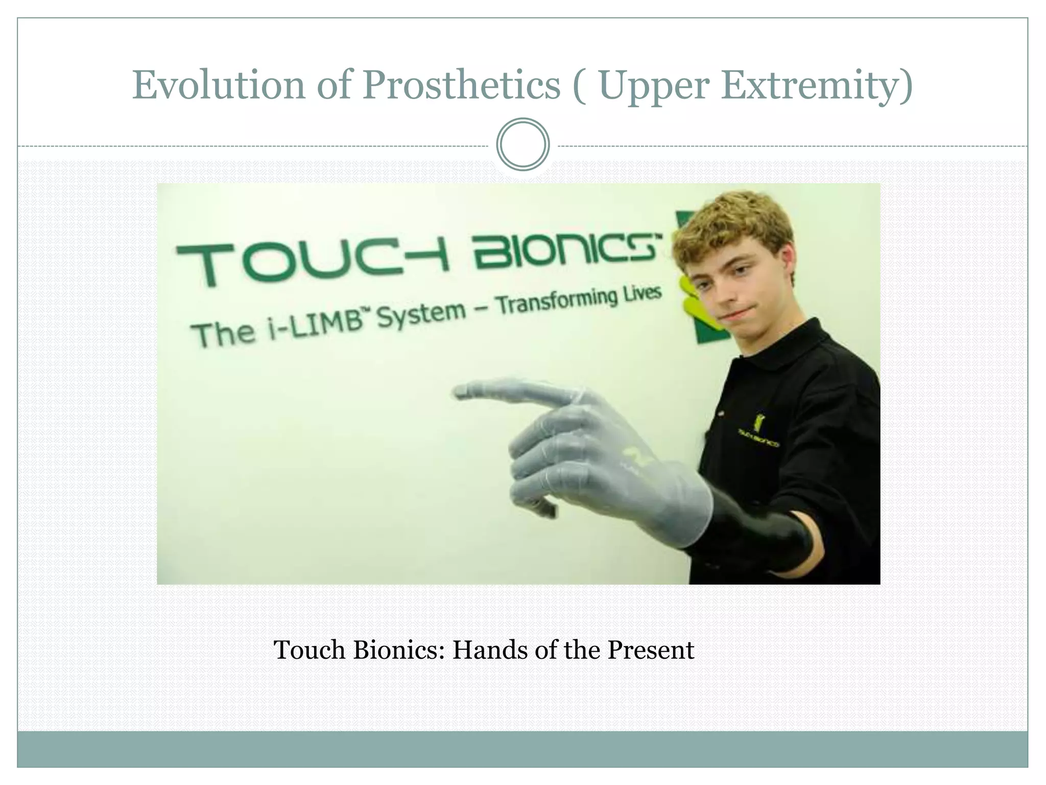 Evolution of Prosthetics ( Upper Extremity)
Touch Bionics: Hands of the Present
 