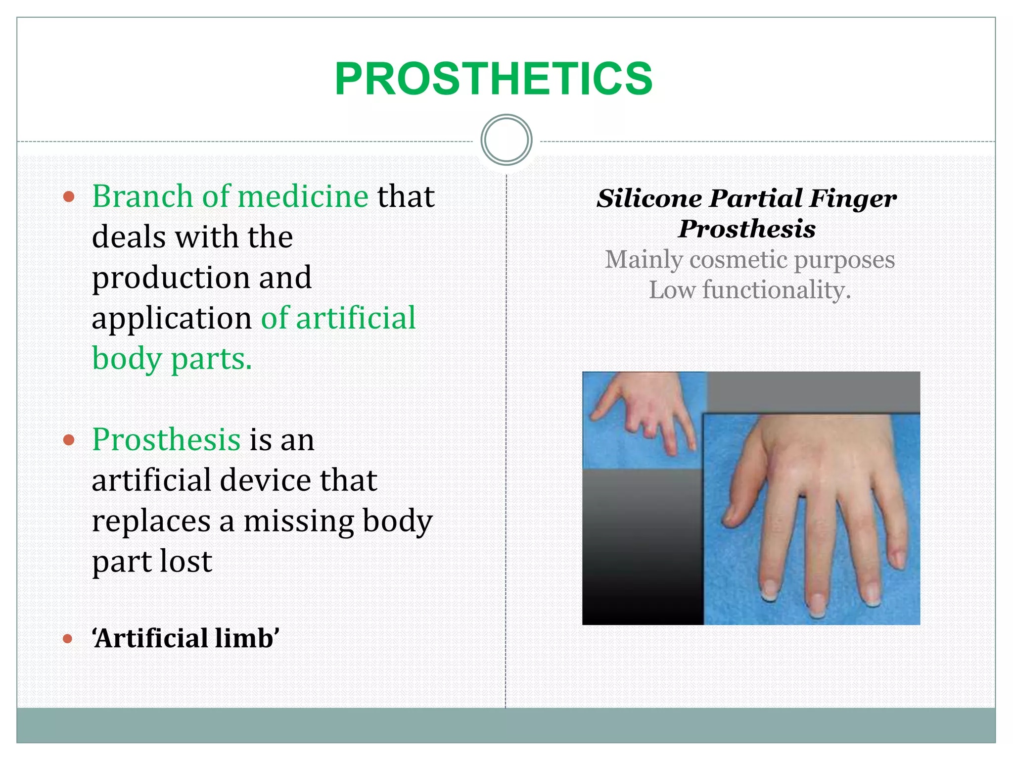 PROSTHETICS
 Branch of medicine that
deals with the
production and
application of artificial
body parts.
 Prosthesis is an
artificial device that
replaces a missing body
part lost
 ‘Artificial limb’
Silicone Partial Finger
Prosthesis
Mainly cosmetic purposes
Low functionality.
 