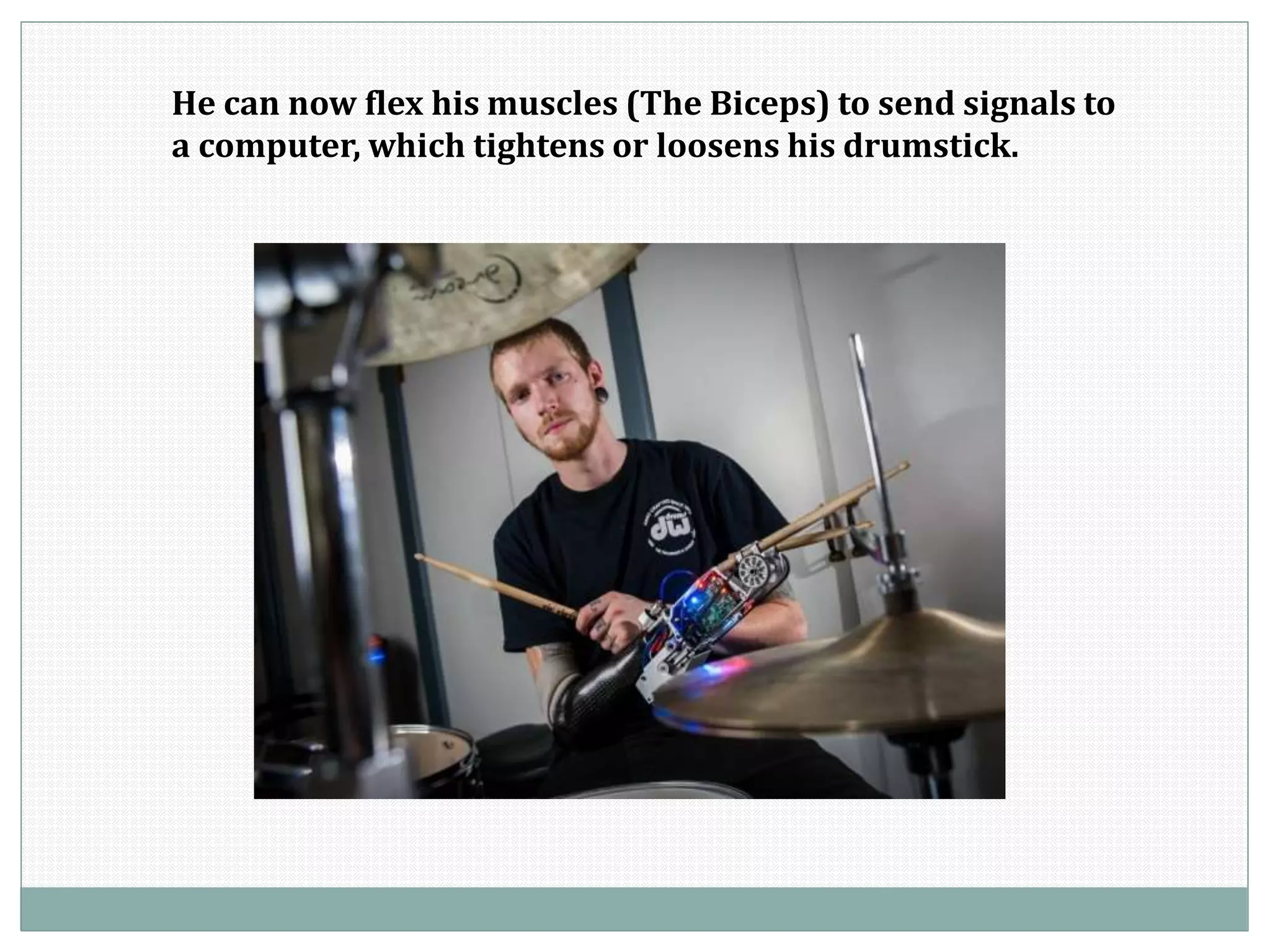 He can now flex his muscles (The Biceps) to send signals to
a computer, which tightens or loosens his drumstick.
 