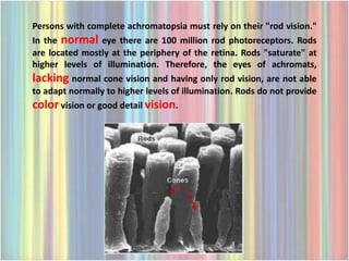 Persons with complete achromatopsia must rely on their "rod vision."
In the normal eye there are 100 million rod photoreceptors. Rods
are located mostly at the periphery of the retina. Rods "saturate" at
higher levels of illumination. Therefore, the eyes of achromats,
lacking normal cone vision and having only rod vision, are not able
to adapt normally to higher levels of illumination. Rods do not provide
color vision or good detail vision.
 