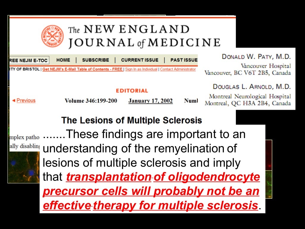 stem cell therapy for ms stem cell therapy for ms