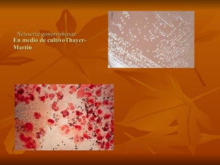 En medio de cultivoThayer-Martin  Neisseria gonorroheoae 