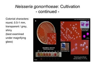 Neisseria gonorrhoeae: Cultivation
- continued -
Colonial characters:
round, 0.5-1 mm,
transparent / grey,
shiny
(best examined
under magnifying
glass)
 