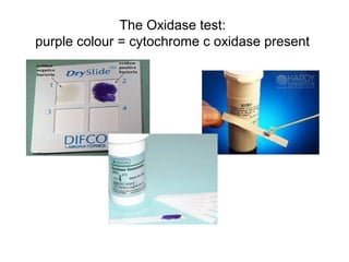 The Oxidase test:
purple colour = cytochrome c oxidase present
 