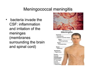 Meningococcal meningitis
• bacteria invade the
CSF: inflammation
and irritation of the
meninges
(membranes
surrounding the brain
and spinal cord)
 