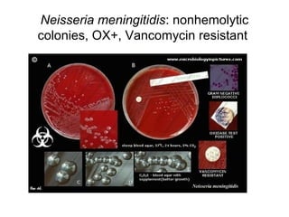 Neisseria meningitidis: nonhemolytic
colonies, OX+, Vancomycin resistant
 