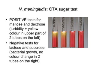 N. meningitidis: CTA sugar test
• POSITIVE tests for
maltose and dextrose
(turbidity + yellow
colour in upper part of
2 tubes on the left)
• Negative tests for
lactose and succrose
(bacterial growth, no
colour change in 2
tubes on the right)
 