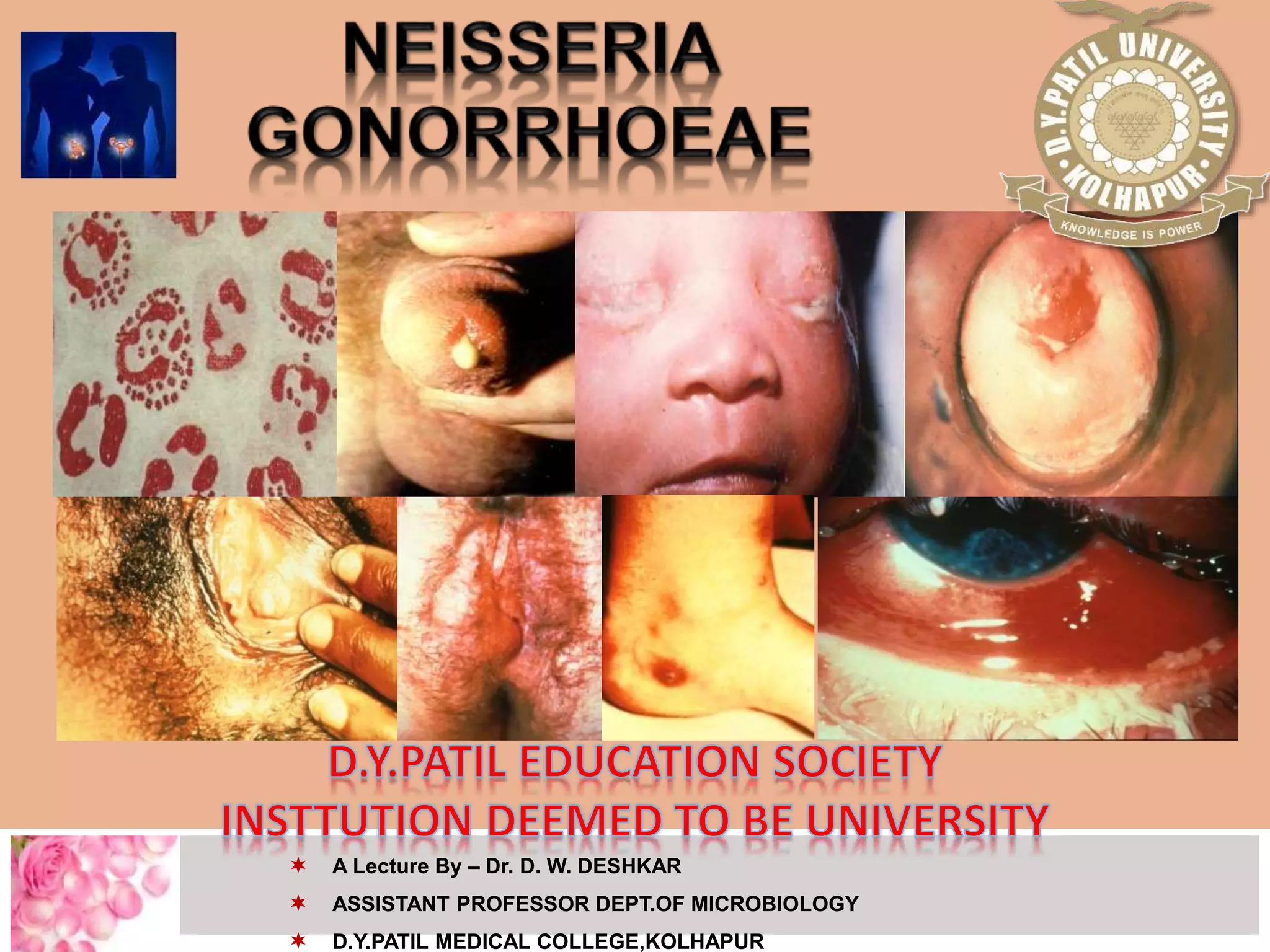 Neisseria gonorrhoeae lecture iii term | PPTX, image size:2048x1536
