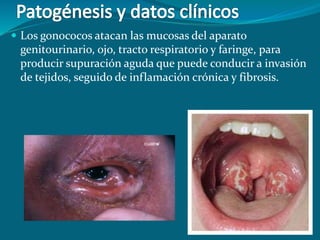 Los gonococos atacan las mucosas del aparato
genitourinario, ojo, tracto respiratorio y faringe, para
producir supuración aguda que puede conducir a invasión
de tejidos, seguido de inflamación crónica y fibrosis.
 