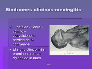 M.RSíndromes clínicos-meningitis    cefalea - fiebre - vómito – convulsiones - pérdida de la conciencia.El signo clínico más prominente es La rigidez de la nuca 