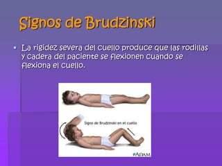 M.RSignos de BrudzinskiLa rigidez severa del cuello produce que las rodillas y cadera del paciente se flexionen cuando se flexiona el cuello. 