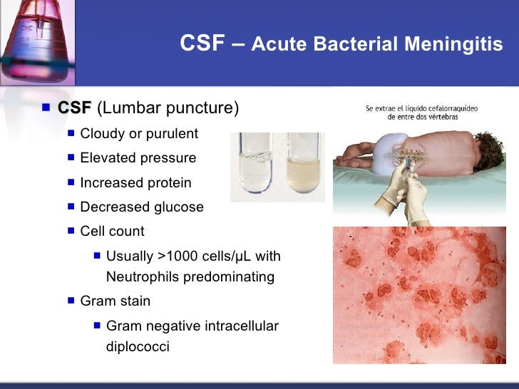 Neisseria Meningitidis