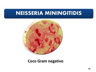 NEISSERIA MININGITIDIS
30
Coco Gram negativo
 