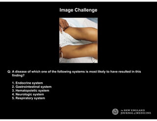Image Challenge
A disease of which one of the following systems is most likely to have resulted in this
finding?
1. Endocrine system
2. Gastrointestinal system
3. Hematopoietic system
4. Neurologic system
5. Respiratory system
Q:
Dr.Sherif
Badrawy
 