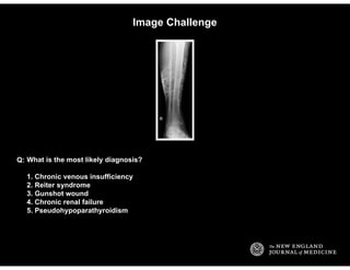 Image Challenge
What is the most likely diagnosis?
1. Chronic venous insufficiency
2. Reiter syndrome
3. Gunshot wound
4. ...