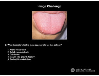 Image Challenge
What laboratory test is most appropriate for this patient?
1. Alpha-fetoprotein
2. Beta2-microglobulin
3. ...