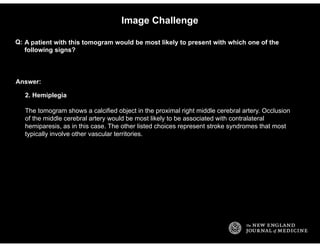 Answer:
Image Challenge
A patient with this tomogram would be most likely to present with which one of the
following signs...