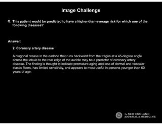 Answer:
Image Challenge
This patient would be predicted to have a higher-than-average risk for which one of the
following ...
