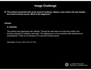 Internal Medicine Image Challenge MCQs