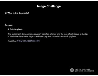 Internal Medicine Image Challenge MCQs
