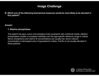 Answer:
Image Challenge
Which one of the following biochemical measures would be most likely to be elevated in
this patien...