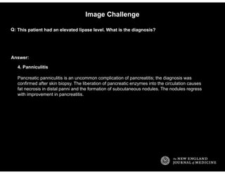Answer:
Image Challenge
This patient had an elevated lipase level. What is the diagnosis?Q:
4. Panniculitis
Pancreatic pan...
