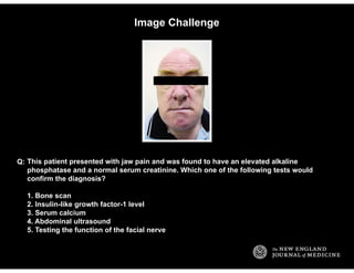 Image Challenge
This patient presented with jaw pain and was found to have an elevated alkaline
phosphatase and a normal s...