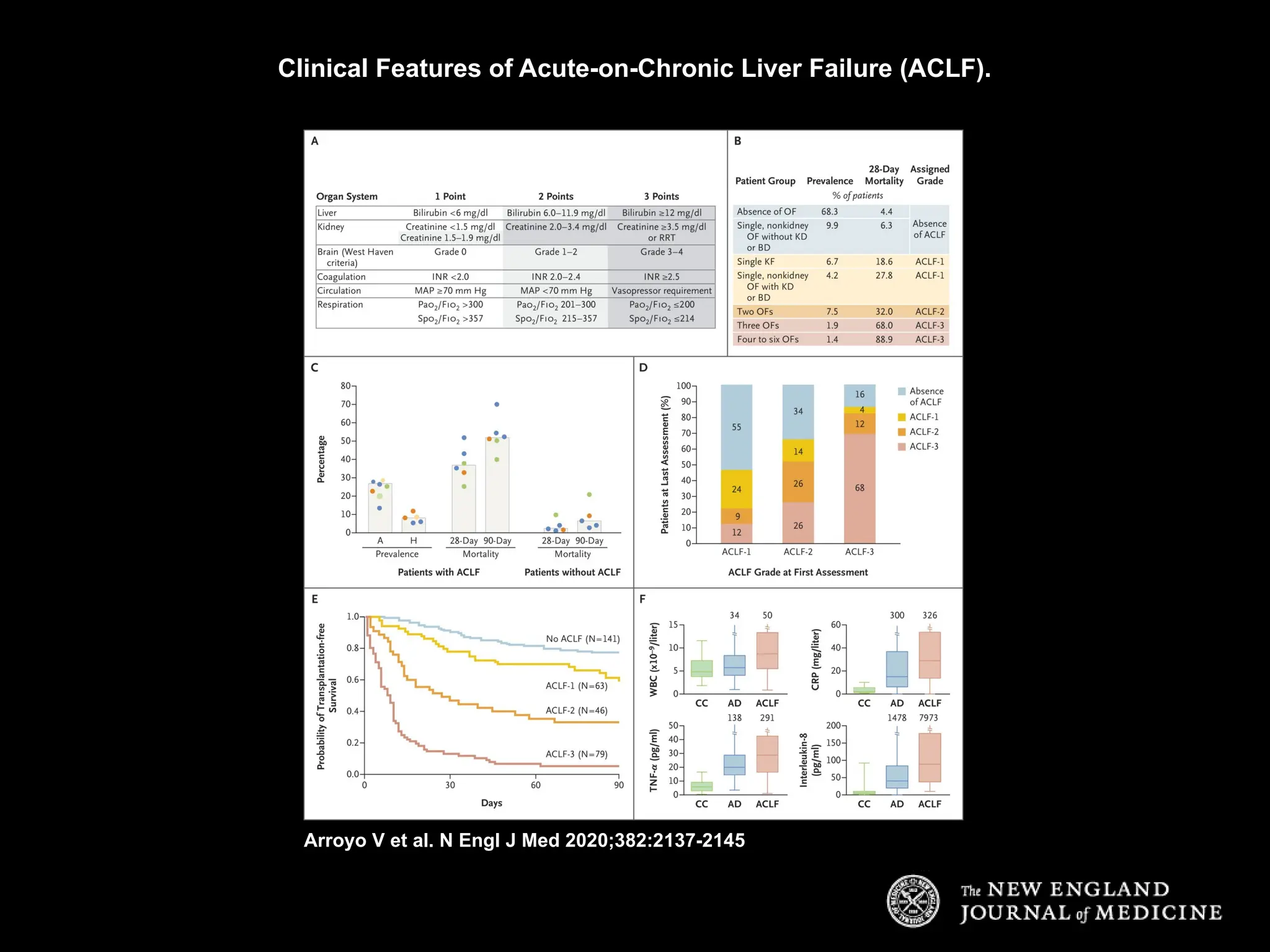 acute on chronic liver failure review article NEJM | PPTX