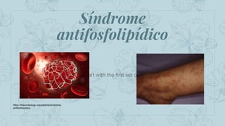 Síndrome
antifosfolipídico
Let’s start with the first set of slides
https://rheumatology.org/patients/sindrome-
antifosfolipidico
 