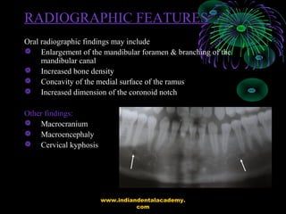 RADIOGRAPHIC FEATURES
Oral radiographic findings may include
 Enlargement of the mandibular foramen & branching of the
ma...