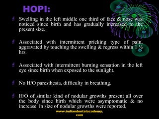 HOPI:
 Swelling in the left middle one third of face & nose was
noticed since birth and has gradually increased to the
pr...