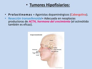 • Tumores Hipofisiarios:
• Prolactinomas = Agonistas dopaminérgicos (Cabergolina).
• Resección transesfenoidal= Adecuada en neoplasias
productoras de ACTH, hormona del crecimiento (el octreótido
también es eficaz).
 